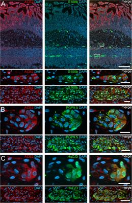 Histological Evidence for the Enteric Nervous System and the Choroid Plexus as Alternative Routes of Neuroinvasion by SARS-CoV2